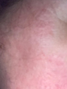 After - Crema Hidratante para piel sensible y rosácea