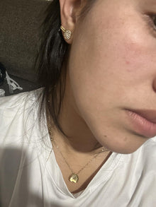 After - bye bye arruguitas