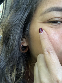 Before - bye bye arruguitas