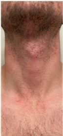 Before - Tengo tres días usándolo ya que mientras llegó a mi país pasaron 15 días desde que lo compré,